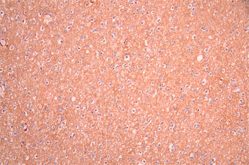 NCAN Antibody
