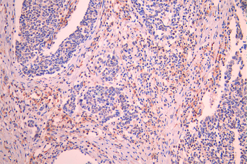 STIM1 Antibody