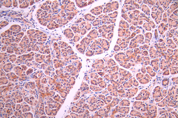 CXCL5 Antibody