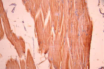 CXCL5 Antibody