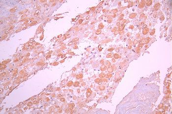 HDAC10 Antibody
