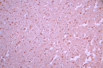 STK39 Antibody