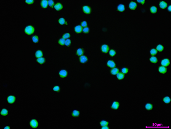 STK39 Antibody