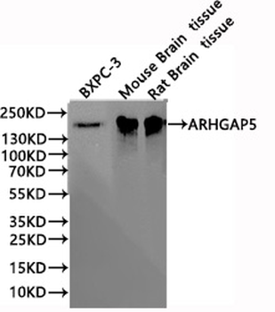 ARHGAP5 Antibody