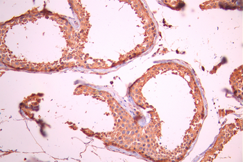 ARHGAP5 Antibody