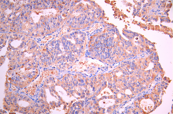 ARHGAP5 Antibody
