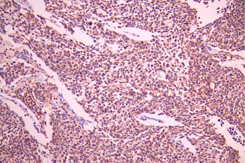 ATF1 Antibody
