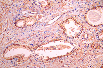 ATF1 Antibody