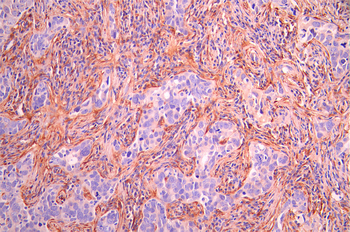 DPYSL3 Antibody