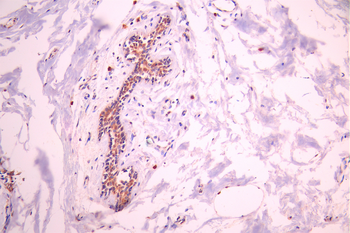 IRF4 Antibody