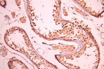 CCNA1/CCNA2 Antibody