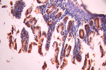 PIM2 Antibody