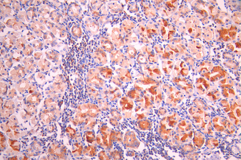 M6PR Antibody