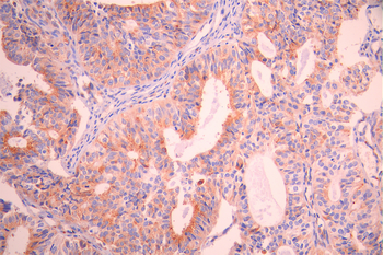M6PR Antibody