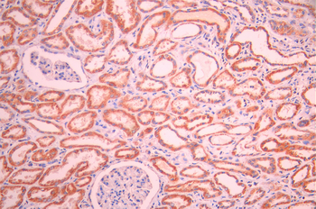 CLPP Antibody