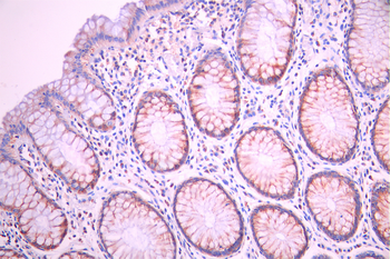 CLPP Antibody