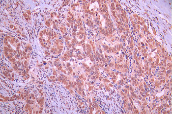 FOSL2 Antibody