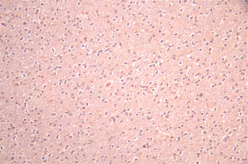 GRIA1 Antibody