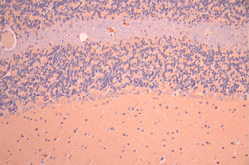 GRIA1 Antibody