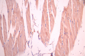 CHRNA5 Antibody