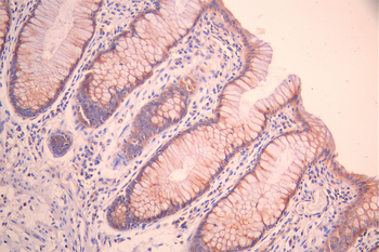 TPO Antibody
