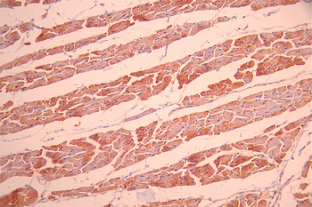 INPP4B Antibody