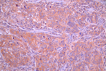 INPP4B Antibody