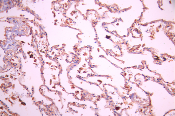 CHRM2 Antibody