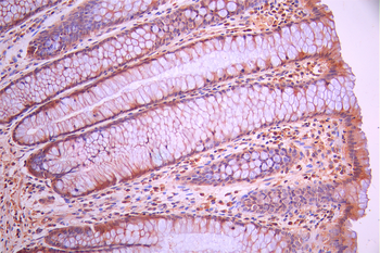 CHRM2 Antibody
