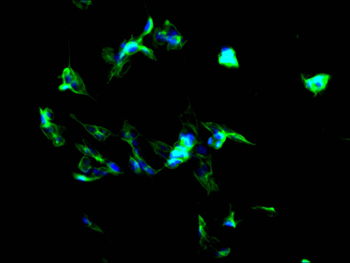 CHRM2 Antibody