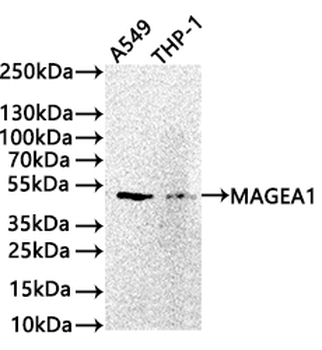 MAGEA1 Antibody