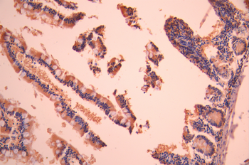 ADA Antibody