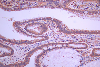 ADA Antibody