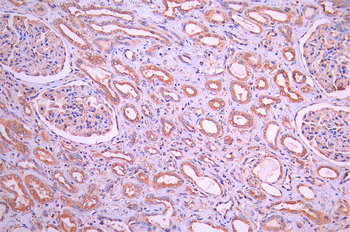 WARS Antibody