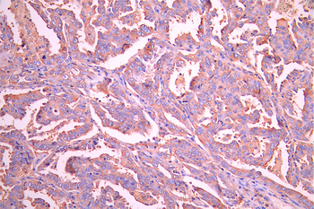 WARS Antibody