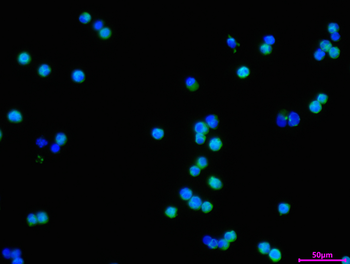 WARS Antibody