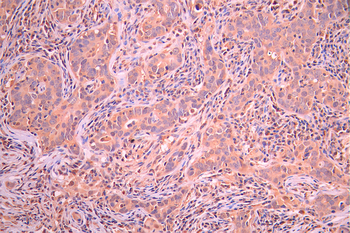 ICOS Antibody