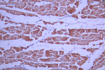 MYL2 Antibody