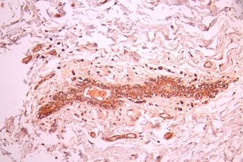 PYCARD Antibody