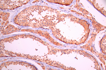 DPYSL5 Antibody
