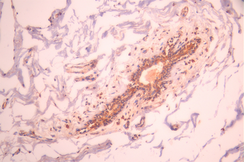 DPYSL5 Antibody