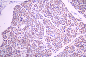 PER2 Antibody