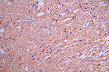 MAG Antibody