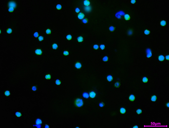 IKBKB/CHUK Antibody