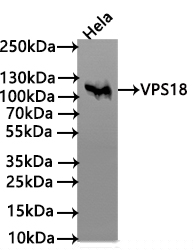 VPS18 Antibody