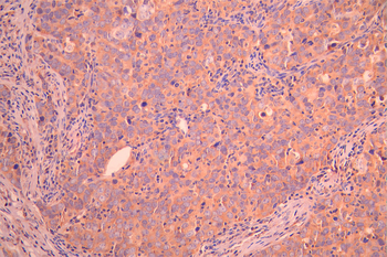 VPS18 Antibody