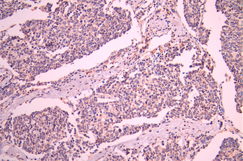 RAP1A/RAP1B Antibody