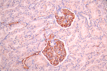 NES Antibody