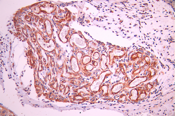 NES Antibody
