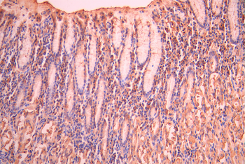 VPS11 Antibody